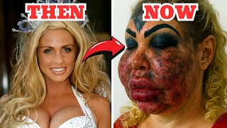 Shock!  50+ Celebrity Plastic Surgery Disasters | Then and Now 2025 | You Won’t Believe the Change!