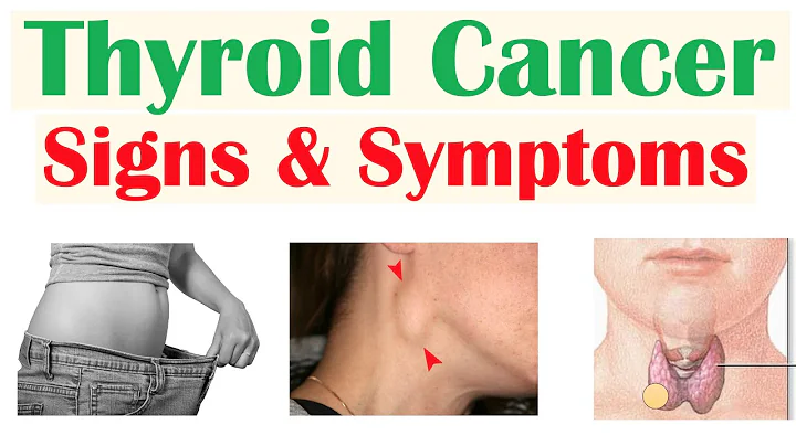 Thyroid Cancer Signs & Symptoms (& Why They Occur) - DayDayNews