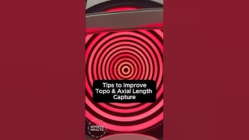 Improving Topography and Axial Length Capture for Myopia Control