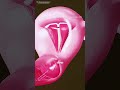 Intrauterine Device (IUDs) For Birth Control #music #motivation #epic #like