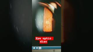 eye ka important part optic disc and fovea
