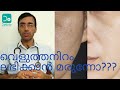 മുഖം വെളുക്കാൻ മരുന്നുണ്ടോ | Glutathione Treatment for Fair Skin Colour | Cost & Effects | Malayalam