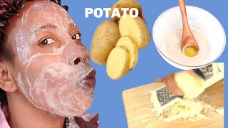 I USE POTATO TO WASH MY FACE, CLEAR BRIGHTER SMOOTH SKIN, CLEAR HYPERPIGMENTATION, REDUCE WRINKLES screenshot 2
