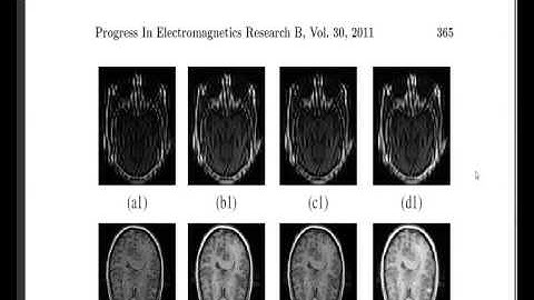 MEDICAL IMAGE FUSION BASED ON RIPPLET TRANSFORM TYPE-I