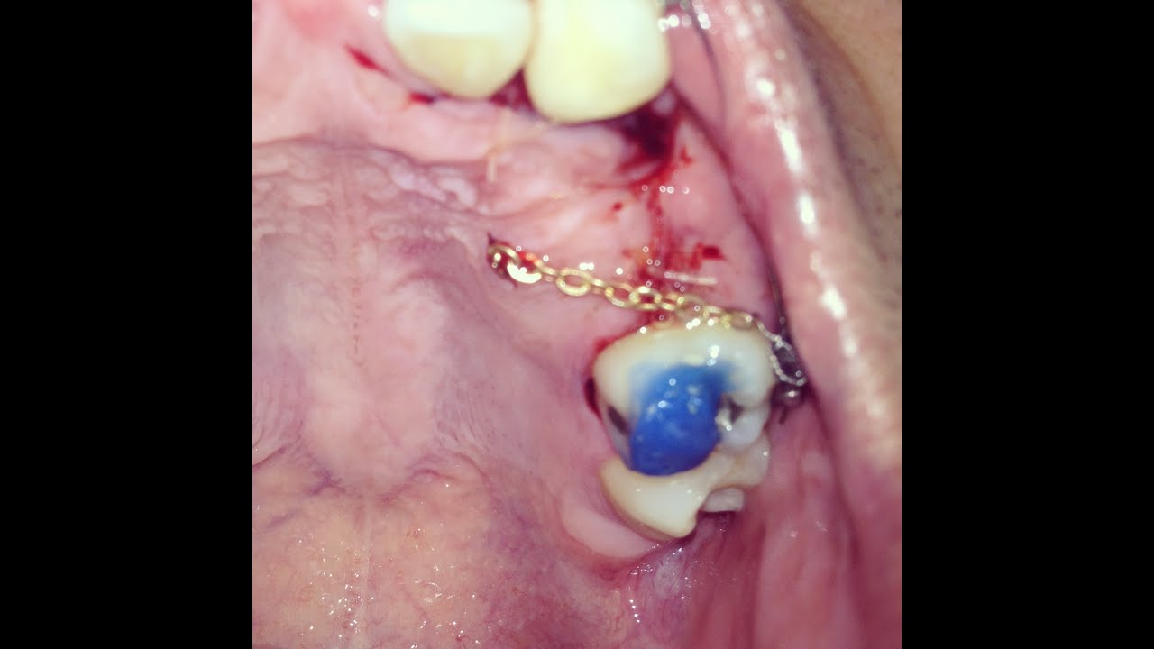 Chain In My Mouth VLOG 295 YouTube