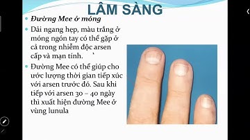 NHIỄM ĐỘC ASEN