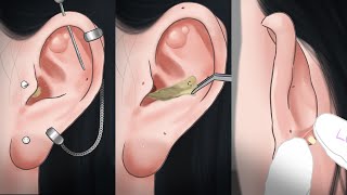 ASMR oddly satisfying Ear Cleaning Animation / Pimple popping, Ear wax removal / Ear Spa LULUPANG