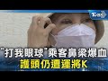 「打我眼球」乘客鼻梁爆血 護頭仍遭運將K｜TVBS新聞 @TVBSNEWS02