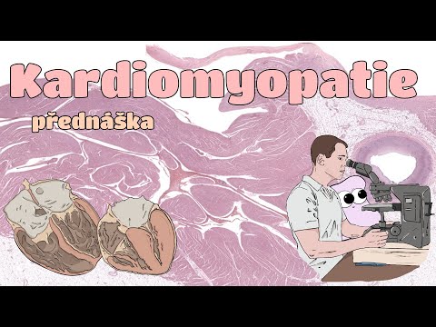 Video: Kardiomyopatie - Typy, Léčba, Příčiny