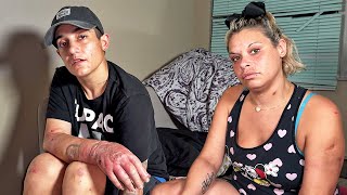 Allyson and Roxy - Drug Use Leads to Infection | Miami Homeless Addiction Interview & Documentary