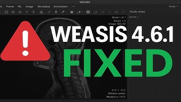 Distribution of an improved version of WEASIS 4.6.1 that resolves a issue.