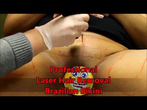 Hair removal for bikini