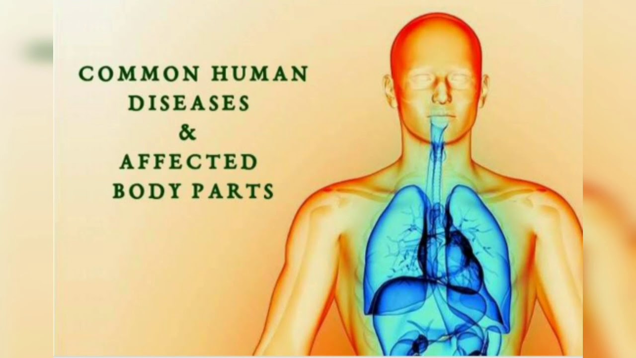 Coclopia Human болезнь.. Human disease