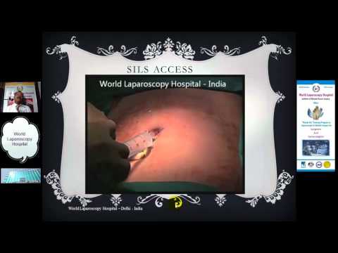 Single Incision Laparoscopic Surgery - Lecture By Dr R K Mishra