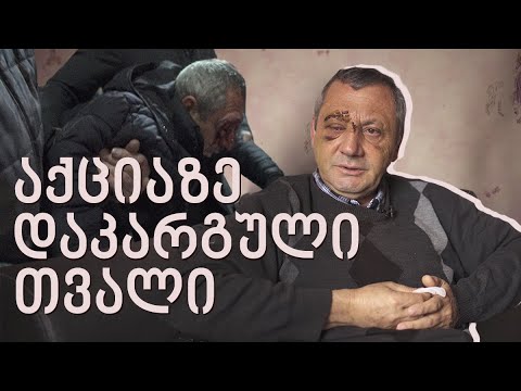 გაბრაზებული კი არა, გამწარებული ვარ! - როგორ დაკარგა ზაზა ბიღიაშვილმა მხედველობა აქციაზე