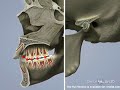 Airway and  TMJ