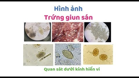 Hình ảnh vi khuẩn nitrat hóa dưới kính hiển vi năm 2024