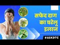 Effective Home Remedies To Treat Vitiligo| Dr. Rohit Goel