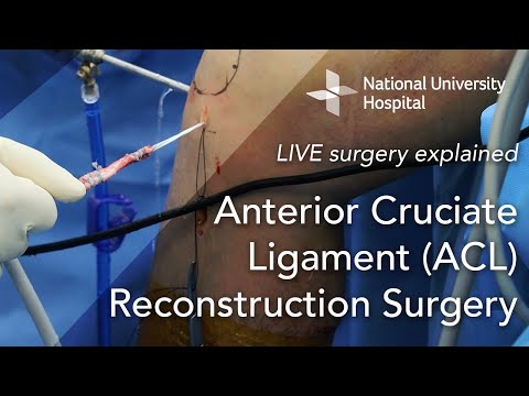 LIVE Surgery Explained: Anterior Cruciate Ligament (ACL) Reconstruction Surgery