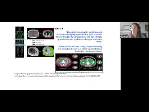 Sarcopenia y composición corporal en pacientes con artritis reumatoidea