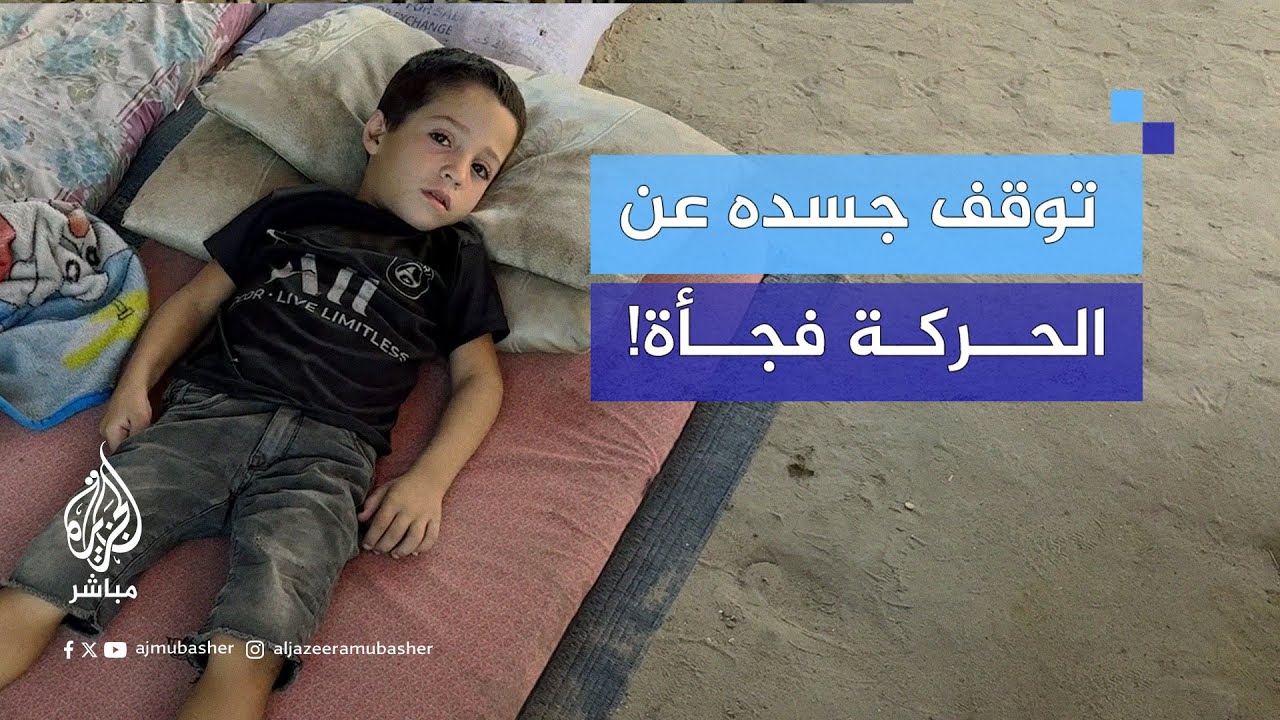 مأساة طفل فلسطيني يفقد قدرته على الحركة مع الوقت وشكٌ كبير بمرض شلل الأطفال