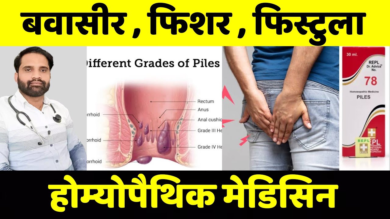 REPL 78 homeopathic medicine in hindi REPL 78 drops uses in hindi