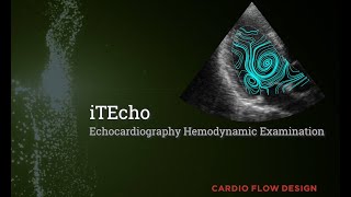 iTEcho™製品紹介