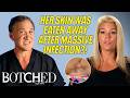 Infected Skin Removal Surgery Left Katina With Huge Open Wounds?! (Before & After) | Botched | E!