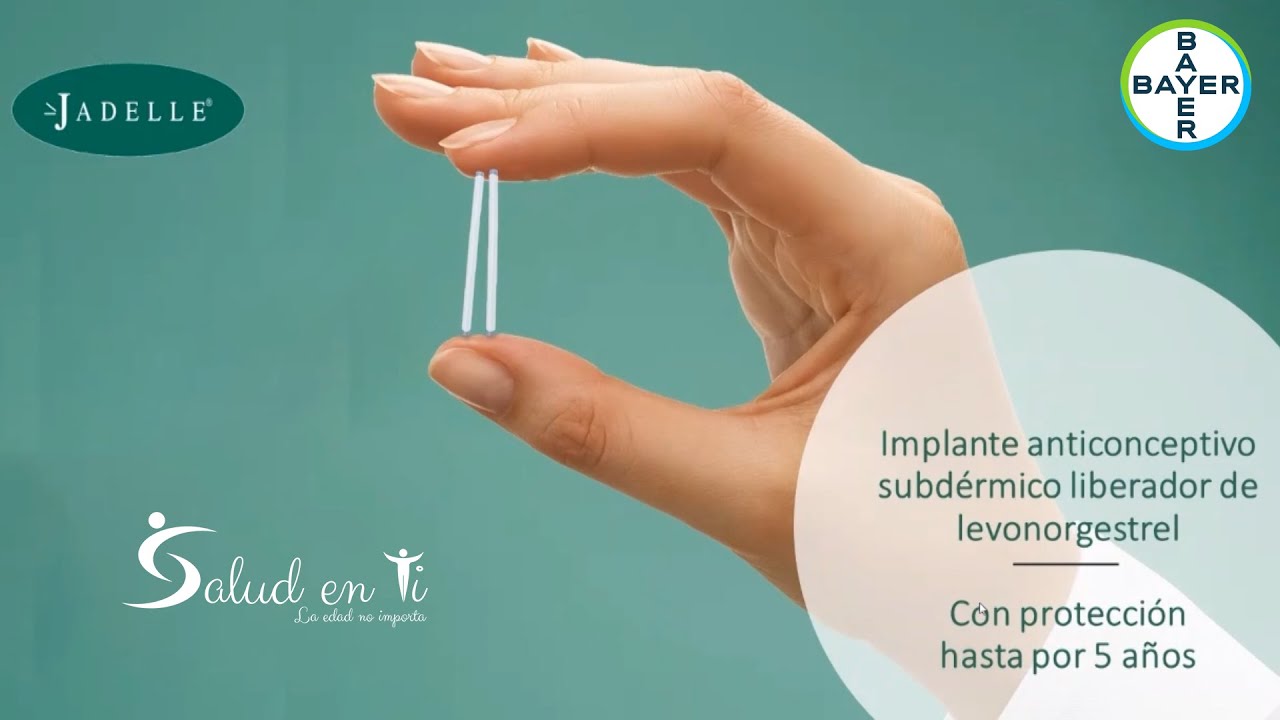 Como funciona el implante anticonceptivo