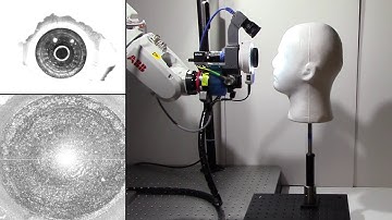 Automatic OCT Imaging of Moving Eyes with a Robotic Scanner