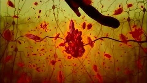 beta amyloid in alzheimer