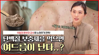 💪🏻운동 열심히 했더니 여드름이?!｜프로틴 파우더 등 보충제를 먹으면 여드름을 유발한다?😰 (꿀팁 가득!🤩) - [누나네피부과]
