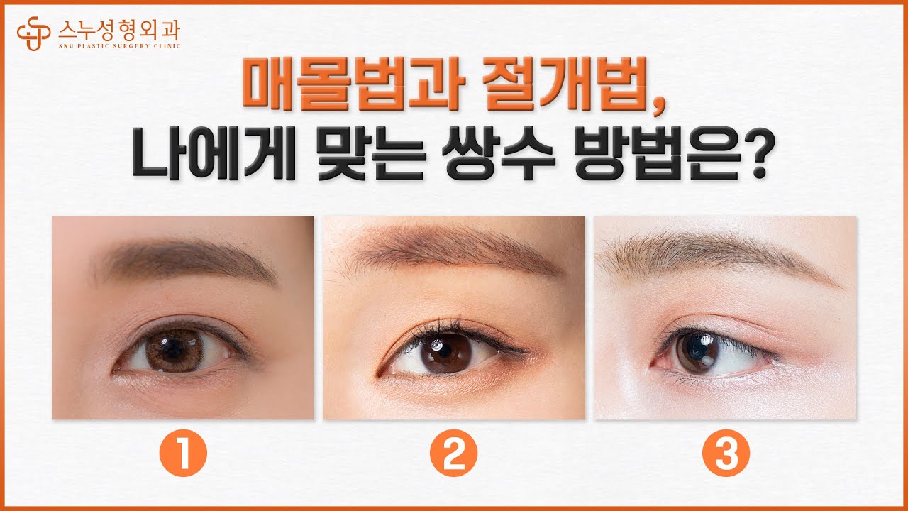 [СНҮ гоо сайхны мэс засал] Зүсэлт хийвэл сорви үлддэг үү? Оёх аргаар хийвэл сулардаг уу? Давхраа хийх мэс заслын бүх үнэнийг дэлгэж байна!