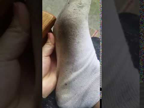 Sweat Dirty Socks and feet after a jog.