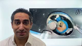 Mechanical Glide Path during Root Canal Treatment | Extreme Endodontics Video Series: EEVS Episode 1
