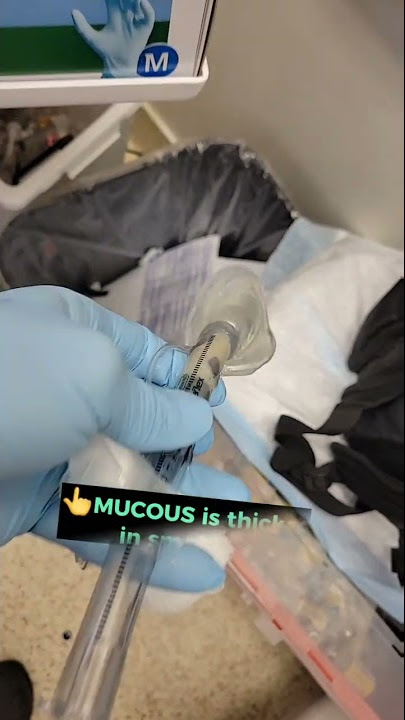 Coughing before surgery? What happens 👀