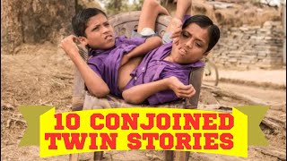 CONJOINED TWINS YOU WON'T BELIEVE EXIST - The freaky truth!