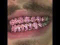 Post Malone with pink diamond rose gold grill