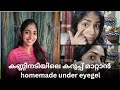 കണ്ണിനടിയിലെ കറുപ്പ് മാറ്റാൻ homemade under eyegel||laincy malu||#darkcircles #undereyedarkcircles