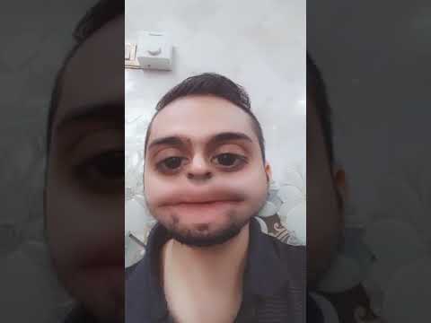 واحد مثل العوجيه اضحك شوفوه تفوتكم