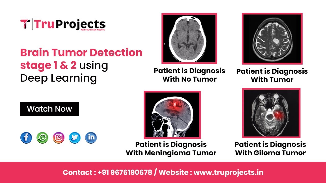 Brain Tumor Detection stage 1 & 2using Deep Learning - YouTube
