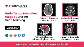 Brain Tumor Detection stage 1 & 2using Deep Learning