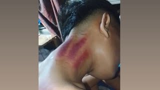 KEROKAN LEHER REMAJA (24)