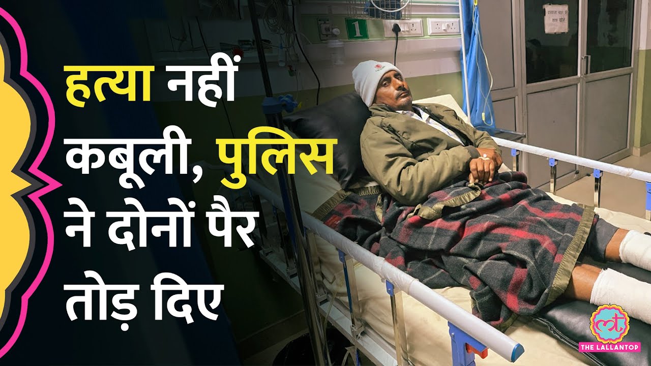 Agra Police ने हत्या कबूलने का प्रेशर बनाया, नहीं मानने पर मार-मारकर दोनों पैर तोड़ डाले