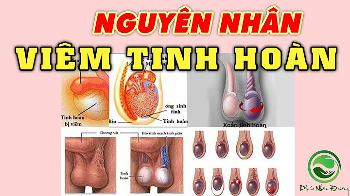 Nguyên nhân gây viêm tinh hoàn là gì năm 2024