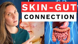 What Skin Flare Ups Reveal About Your Gut