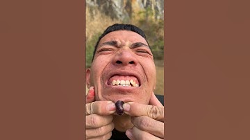 How I Cured a Bug Bite with Yogurt in theWild |Survival Hacks#shorts