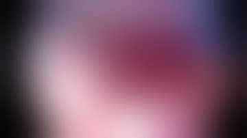 Uniportal VATS right lower anatomic subsegmentectomy and segmentectomy S8a+S6