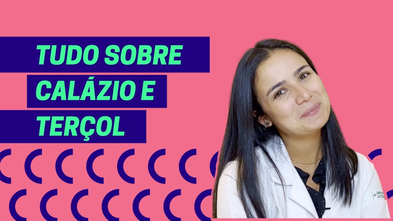 O que é calázio? Quais os sintomas? Como é tratado?