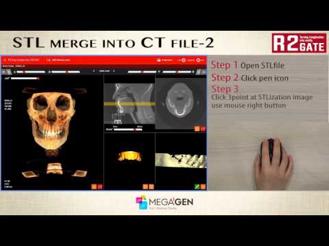 STL merge into CT file 2